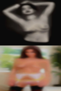 Devlandcummins, Vernia Devlandcummins, Vernia
